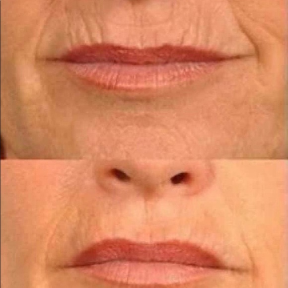 COPY - Line corrector - Picture 3 of 4